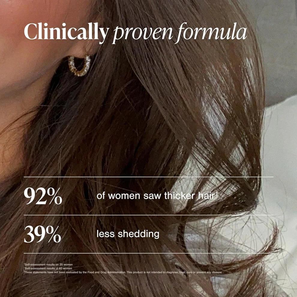 Viviscal Hair Growth Supplements for Women – Biotin & Marine Collagen, 180 Tablets (90-Day Supply)